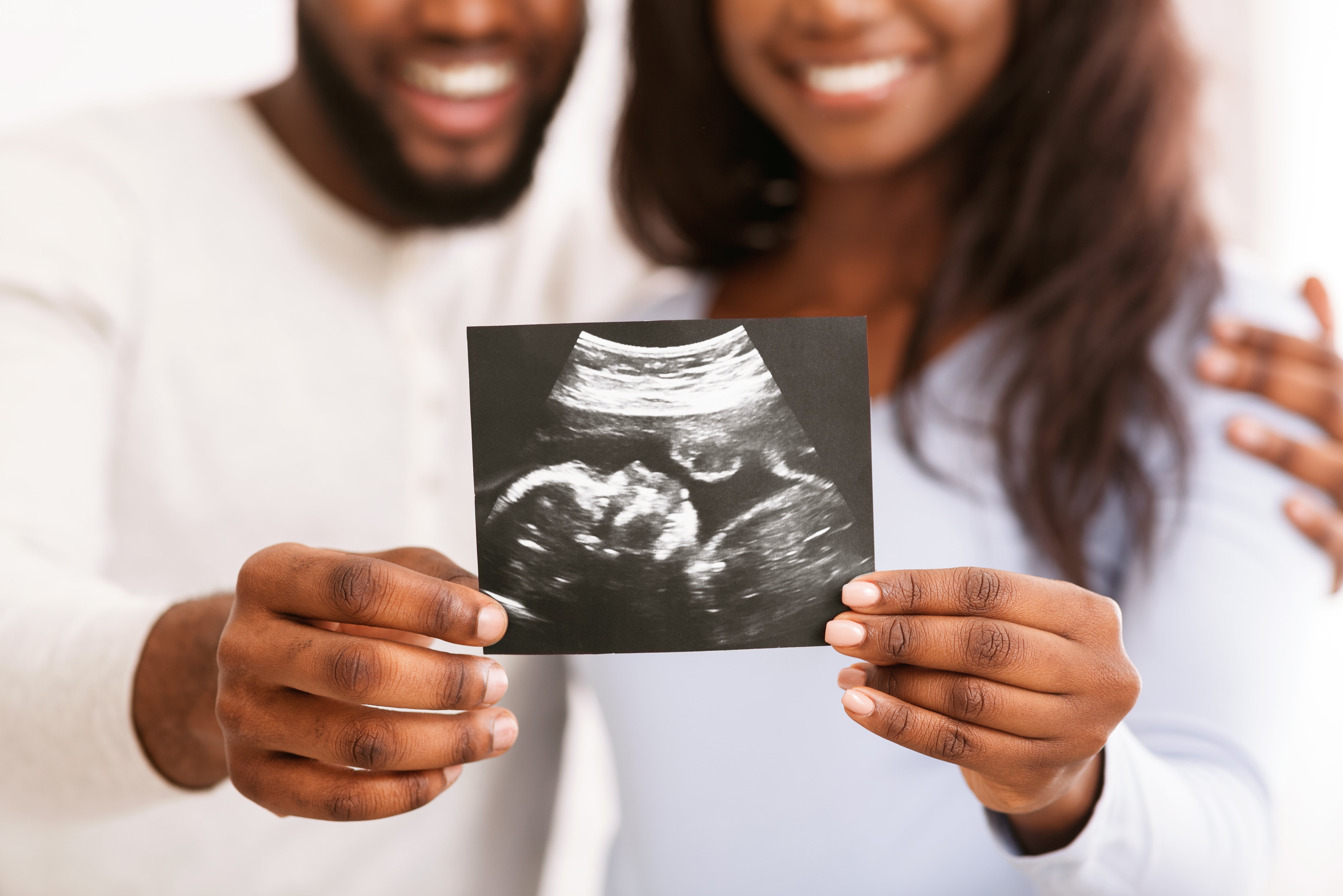 Expecting? How Much Does an Ultrasound Cost?